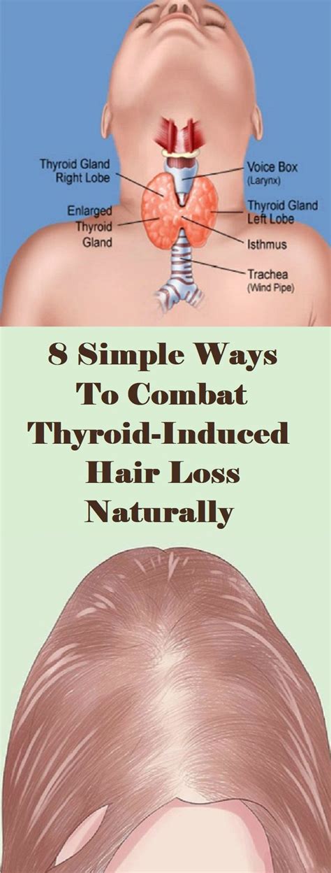 How Can I Fix My Hair Loss Due To Thyroid - Best Simple Hairstyles for Every Occasion