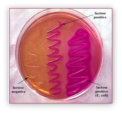 MacConkey Agar Plates- Know Your Media - Advancells Group