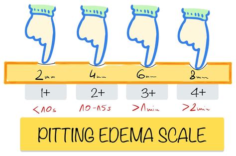 edema scale chart Pin on oposiciones enfermería