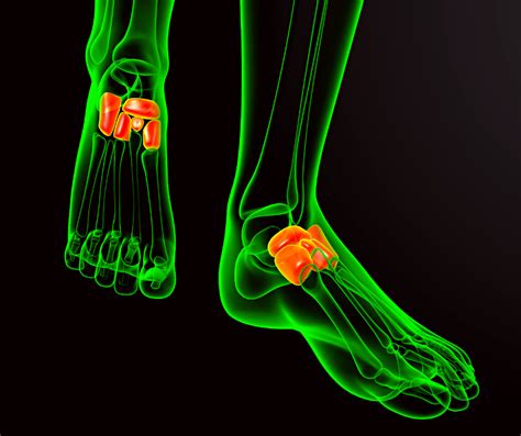 What is Cuboid Syndrome? - Almawi Limited The Holistic Clinic