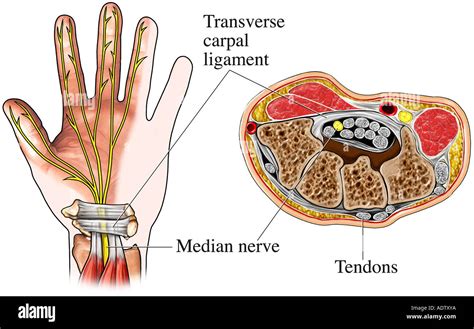 Transverse carpal ligament hi-res stock photography and images - Alamy