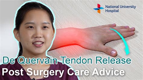 De Quervain tenosynovitis - Post-Surgery Care Advice - YouTube