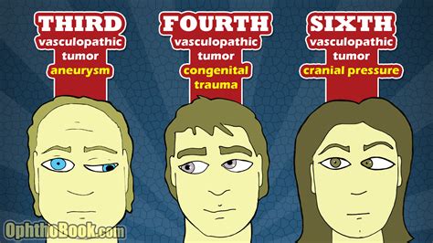 Neuro-ophthalmology - School of Medicine Blogs - Stanford University School of Medicine ...