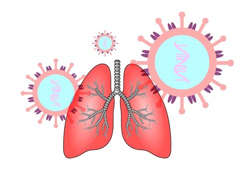 Mesoblast’s remestemcel-L lowers mortality in Covid-19 ARDS patients