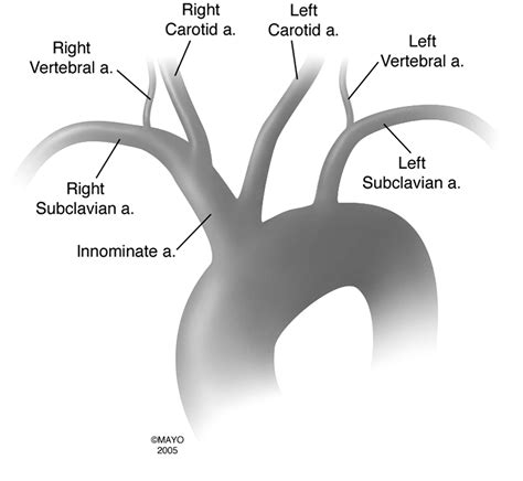 Arteries Of The Aortic Arch