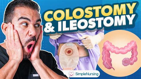 Colostomy and Ileostomy Nursing | Indications, Complications, Care EASY ...