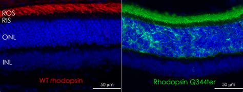 Review: Defective Trafficking of Rhodopsin and Its Role In Retinal ...