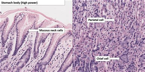 Stomach – Normal Histology – NUS Pathweb :: NUS Pathweb