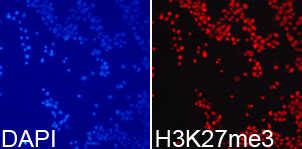 Histone H3K27me3 Polyclonal Antibody - SAB | Signalway Antibody