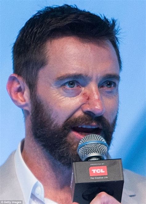 Hugh Jackman reveals the true extent of having skin cancer at X-Men ...