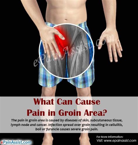 Women Groin Muscles Diagram