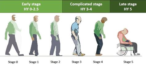 The Hoehn & Yahr scale classifying different stages of Parkinson's ...