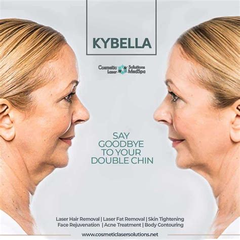 Best Chin Fat Removal Near Me | Kybella & Agnes RF Cost Boston