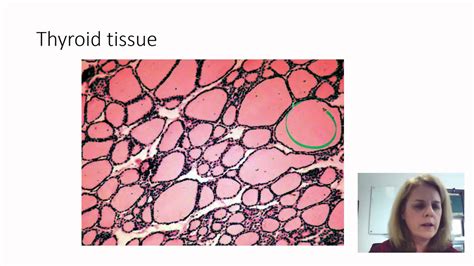 Endocrine Histology - YouTube