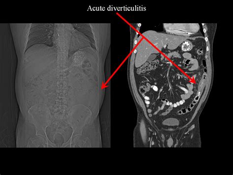 On Call Radiology - common radiology findings on call and in the Emergency Room and during the ...