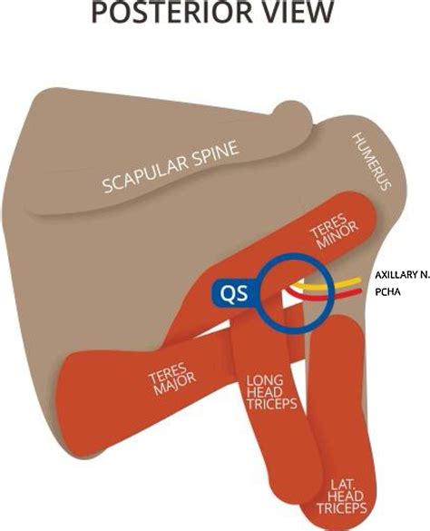 Diagnostic properties of the SPIQuestionnaire to detect Posterior ...