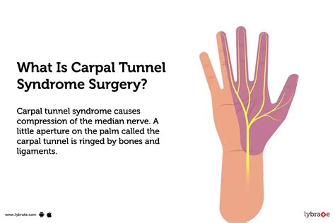 Carpal Tunnel Syndrome Surgery: Purpose, Procedure, Benefits and Side Effects