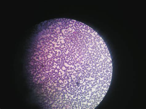 Staphylococcus Aureus Microscope