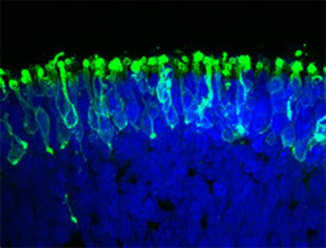 Eye in a Dish: Researchers Make Retina From Stem Cells - NBC News