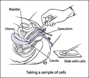 What Is Pap Smear Test for Women, Test Procedure and Results - What is Gardasil Vaccine ...