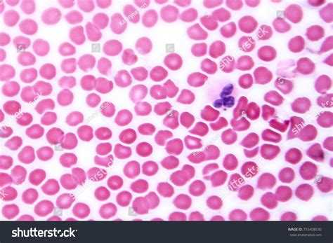 Human Blood Smear Under Microscope Light Stock Photo 755408530 ...