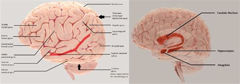 Labelled brain model of PPA. These brain images are snapshots of 3D ...