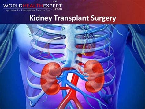 Kidney Transplant Surgery Procedure