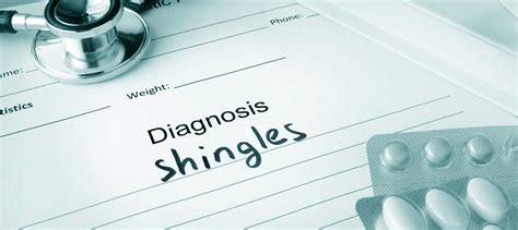 What Is The Best Pain Reliever For Shingles? - Healthy Directions