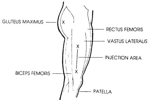 Administer Intramuscular, Subcutaneous, and Intradermal Injections