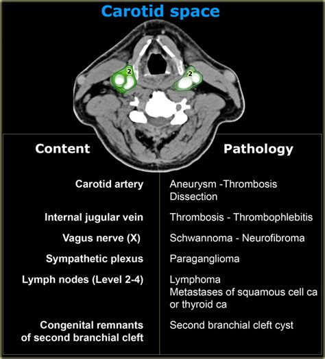 Neck Vessels Ct Anatomy - ANATOMY STRUCTURE