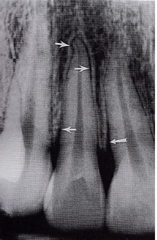 Intraoral Anatomy Flashcards | Quizlet