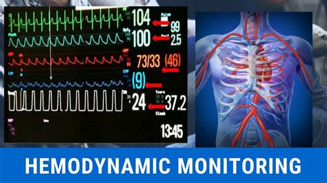 Hemodynamic Monitoring - YouTube