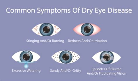 Dry Eye - Fraser Valley Cataract & Laser