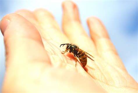 How to Treat a Bee or Wasp Sting | Top 10 Home Remedies