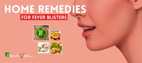 12 Easy and Best Home Remedies for Fever Blisters