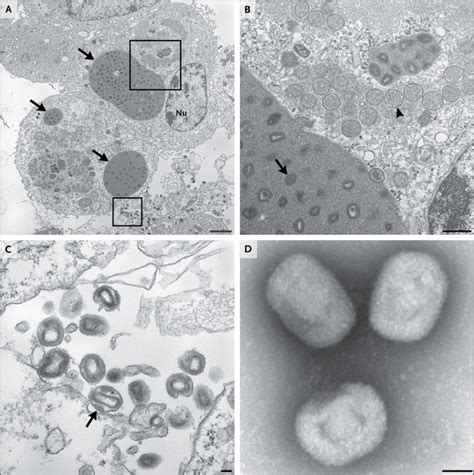 The Novel Orthopoxvirus on Transmission Electron Microscopy ...