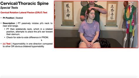 Cervical Rotation Lateral Flexion (CRLF) Test | Rationale ...