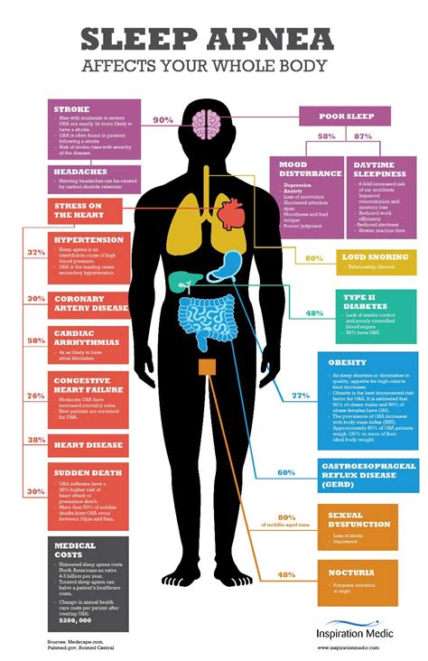 Obstructive Sleep Apnea Explained - Inspiration Medic