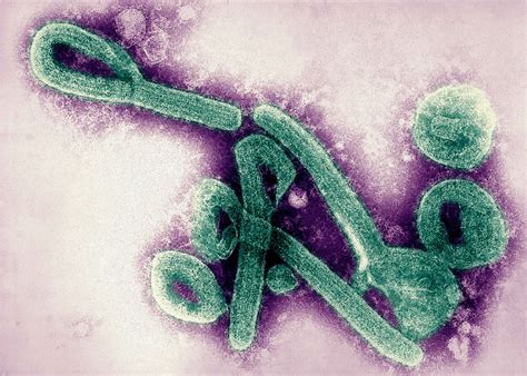 Marburg virus transmission, disease, symptoms, diagnosis & treatment