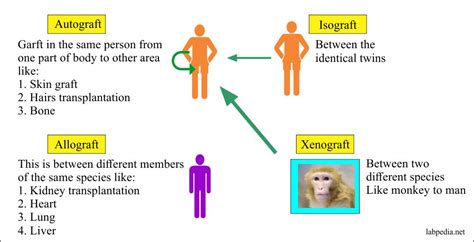 Chapter 15: Transplantation and Rejection Phenomenon - Labpedia.net