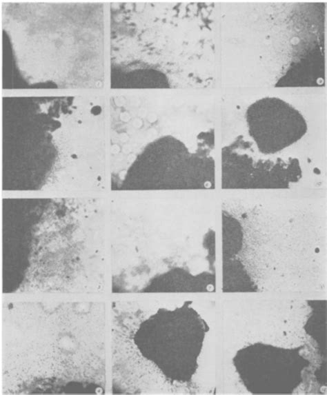 Figure 1 from Effect of Direct Applications of Tyrothricin and Allantoin to Cells in vitro.∗ ...