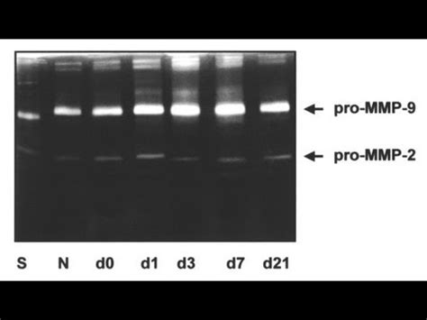 Gelatin Zymography - Amrita University - YouTube