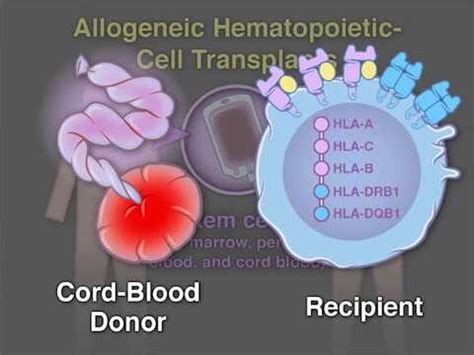 Cord-Blood Transplant - YouTube