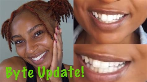 FIXING MY TEETH UPDATE! Byte with photos! affordable aligners company | iamLindaElaine - YouTube