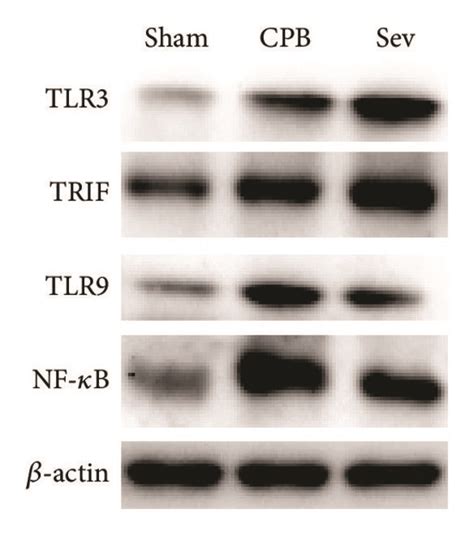 Western blot used to detect the TLR3 and TLR9 signaling pathway related... | Download Scientific ...