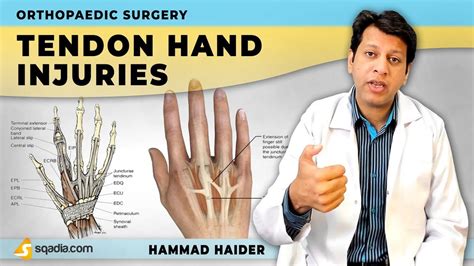 Extensor Tendon Hand