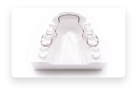 Lower Lingual Arch – Dentallab32.com