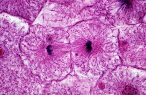 Telophase Of Mitosis Under Microscope