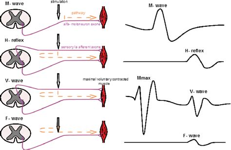 Applications of the H-reflex in kinesiology: a systematic review | Semantic Scholar