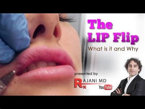 Lip Flip Botox Before And After Photos - Infoupdate.org